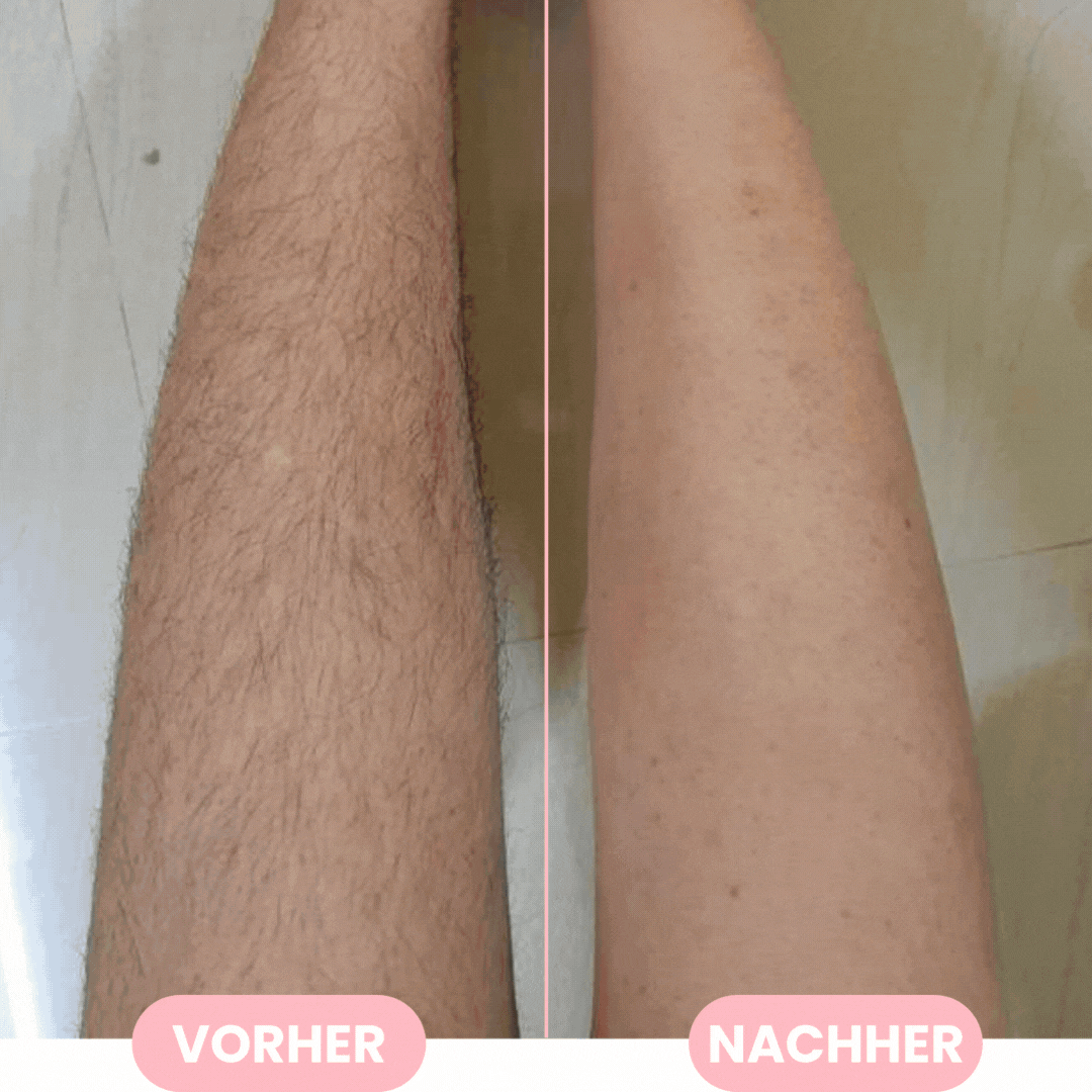 Original Saphir - Haarentferner